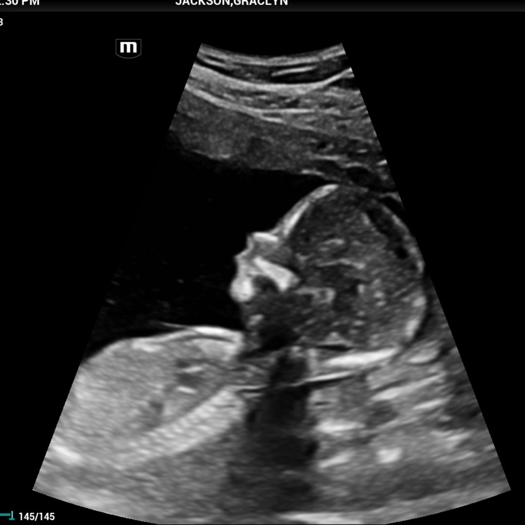 Photo shared by Gracy for their Babylist baby registry.