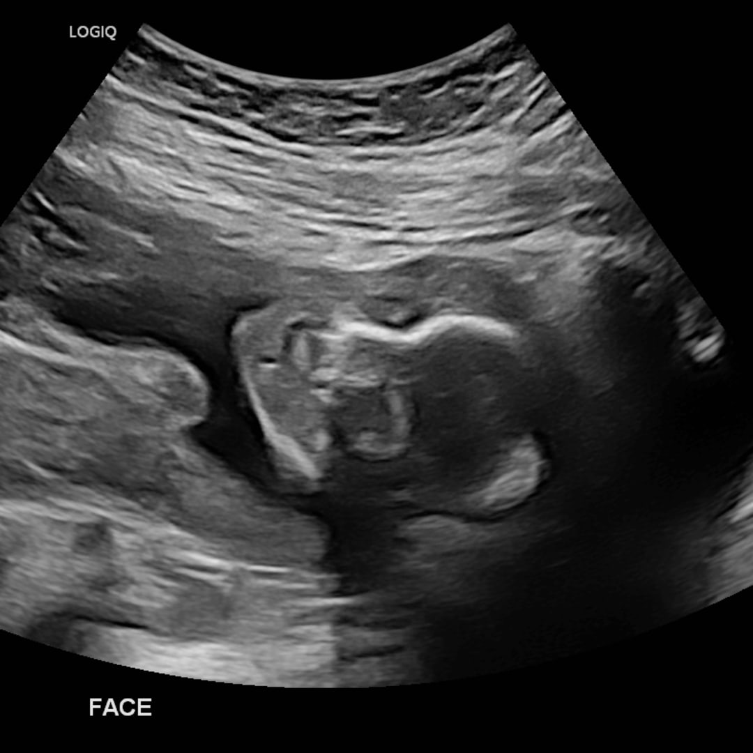 Photo shared by Esmeralda for their Babylist baby registry.