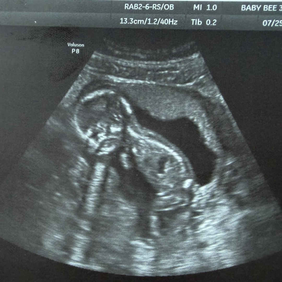 Photo shared by Gabrielle for their Babylist baby registry.