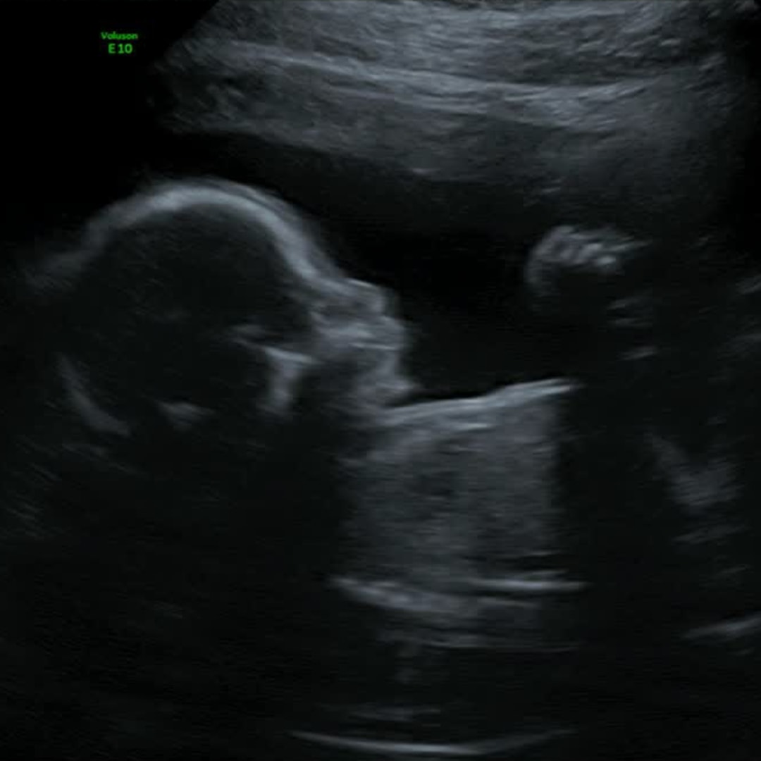 Photo shared by Christine & Miguel for their Babylist baby registry.