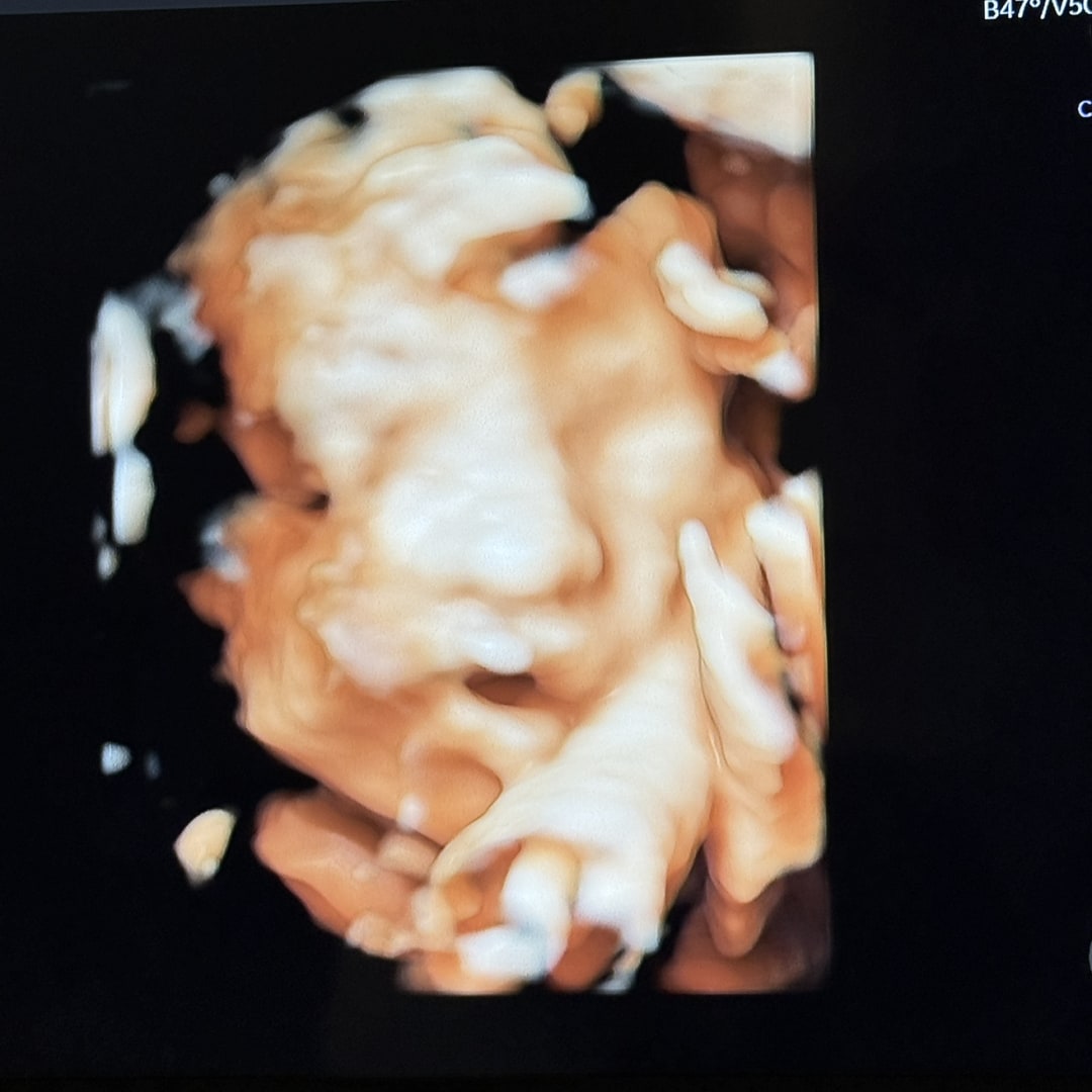 Photo shared by Lennis for their Babylist baby registry.