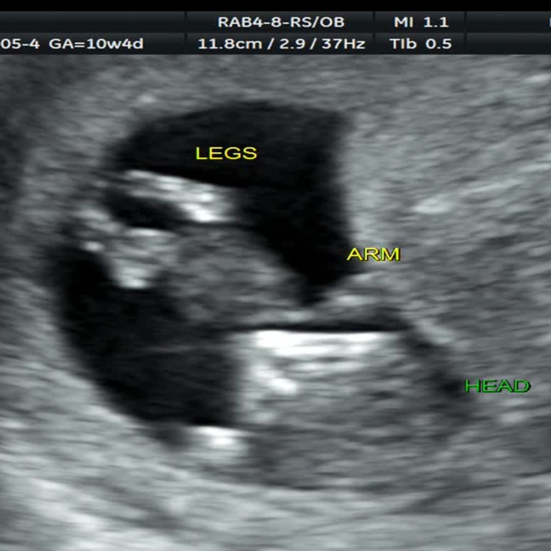 Photo shared by Tina for their Babylist baby registry.