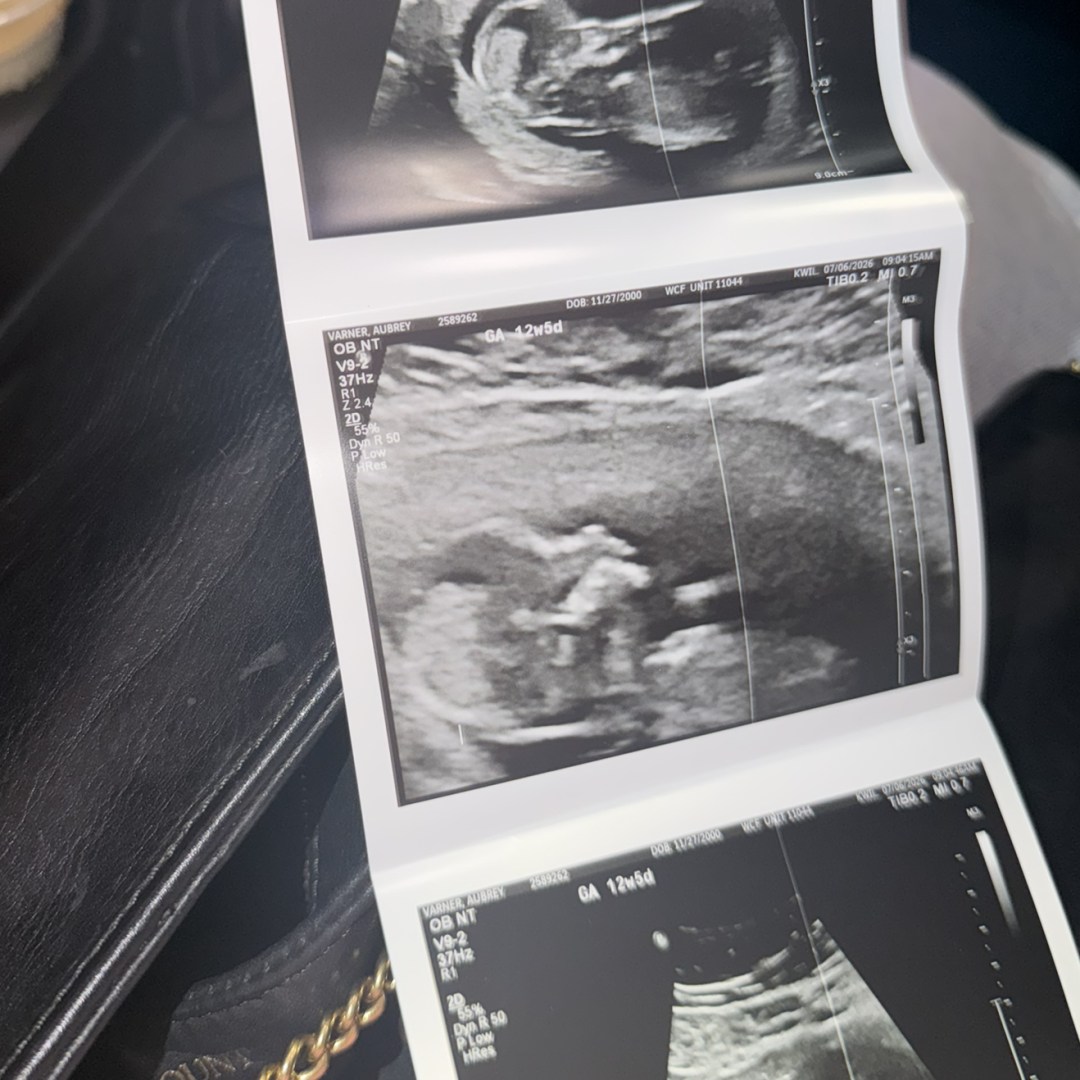 Photo shared by Aubrey for their Babylist baby registry.