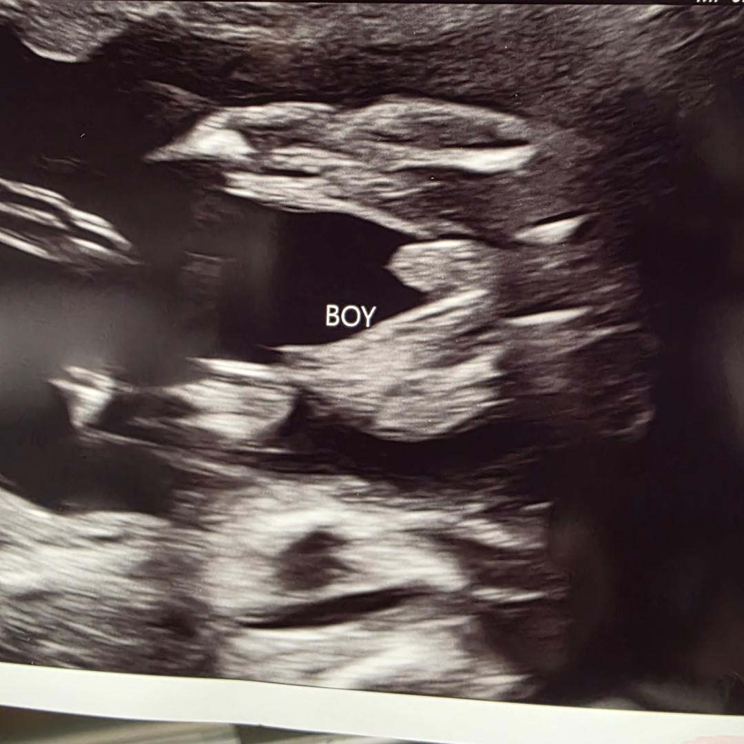 Photo shared by Chelsea for their Babylist baby registry.