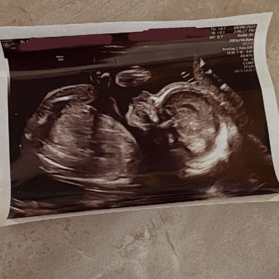 Photo shared by Miracle for their Babylist baby registry.