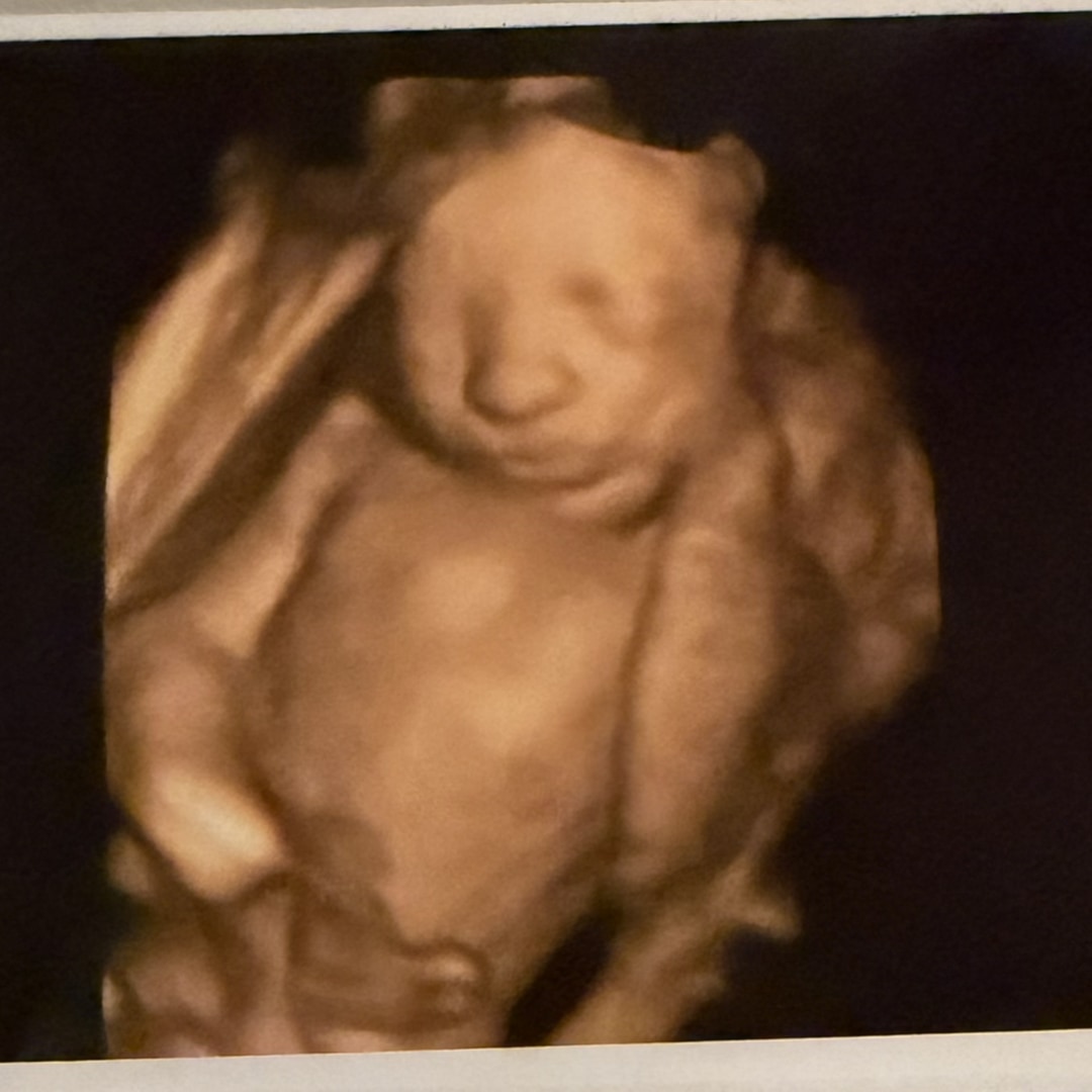 Photo shared by Aubrey for their Babylist baby registry.