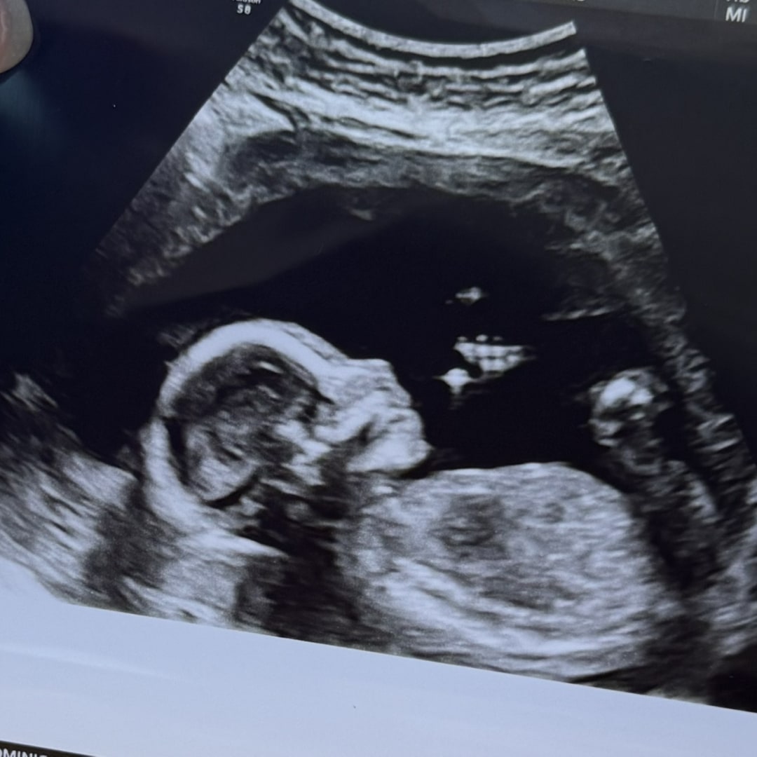 Photo shared by Nikki for their Babylist baby registry.