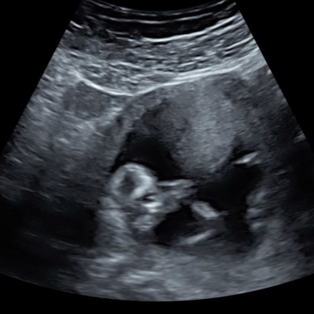 Photo shared by Frances for their Babylist baby registry.