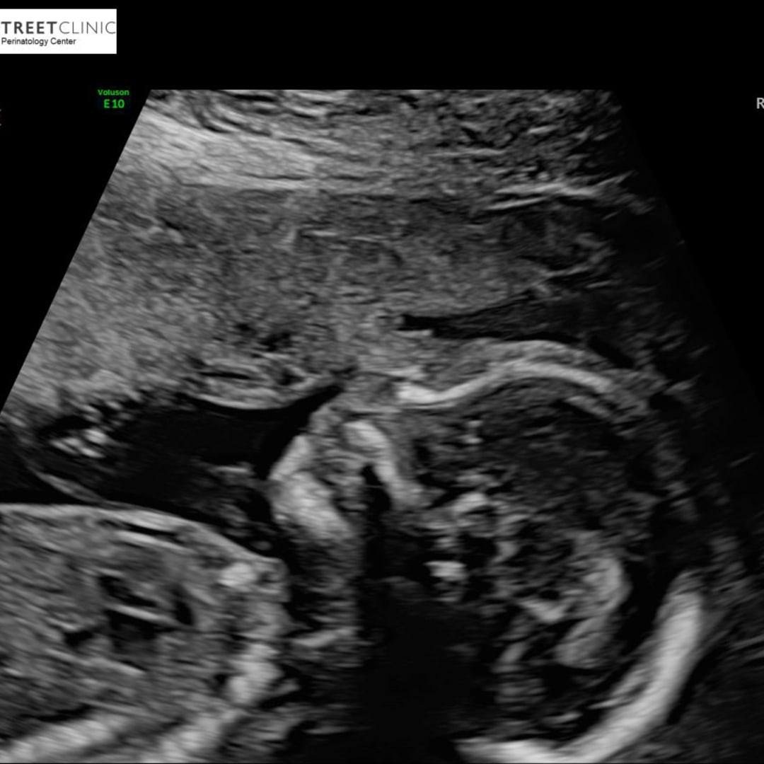 Photo shared by Gabby for their Babylist baby registry.