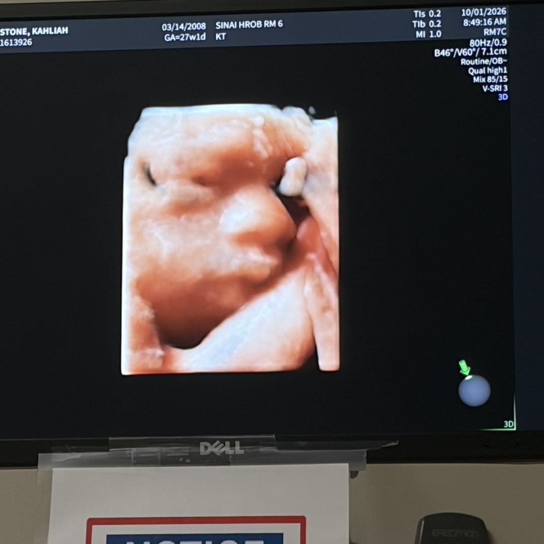 Photo shared by Kahliah for their Babylist baby registry.