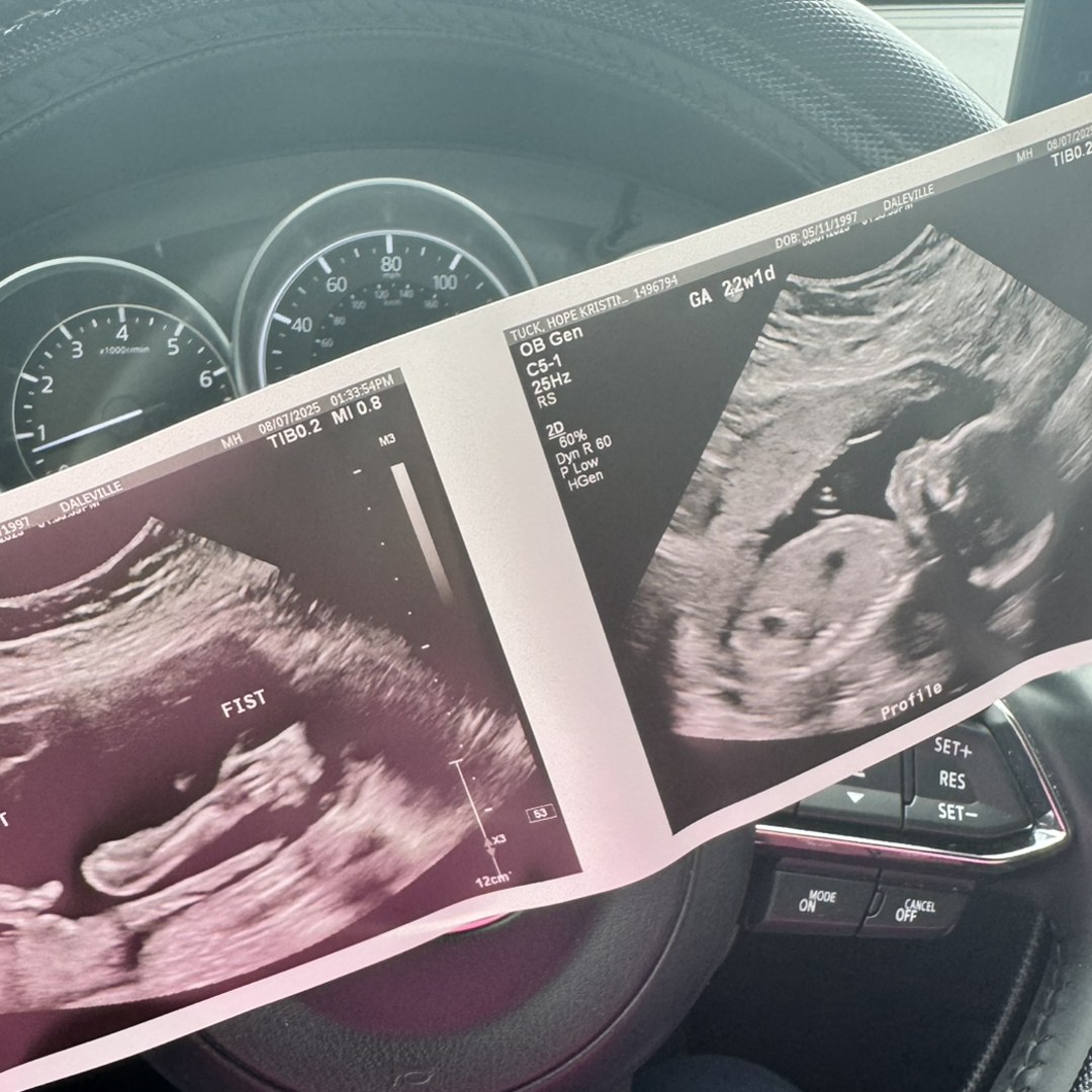 Photo shared by Hope for their Babylist baby registry.