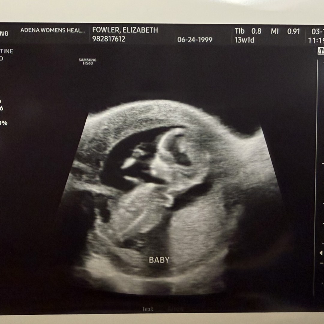 Photo shared by Elizabeth for their Babylist baby registry.