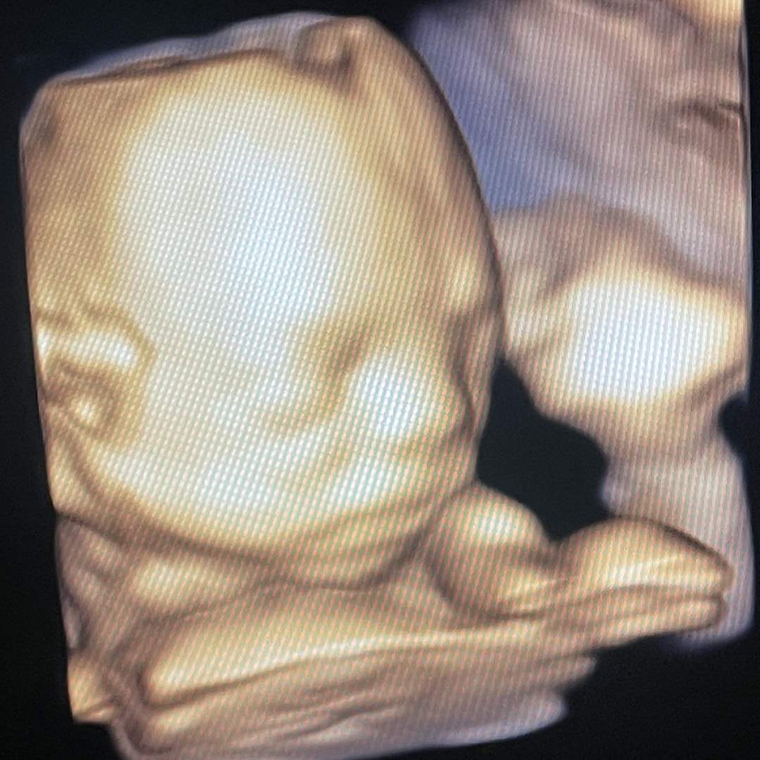 Photo shared by Daisy for their Babylist baby registry.