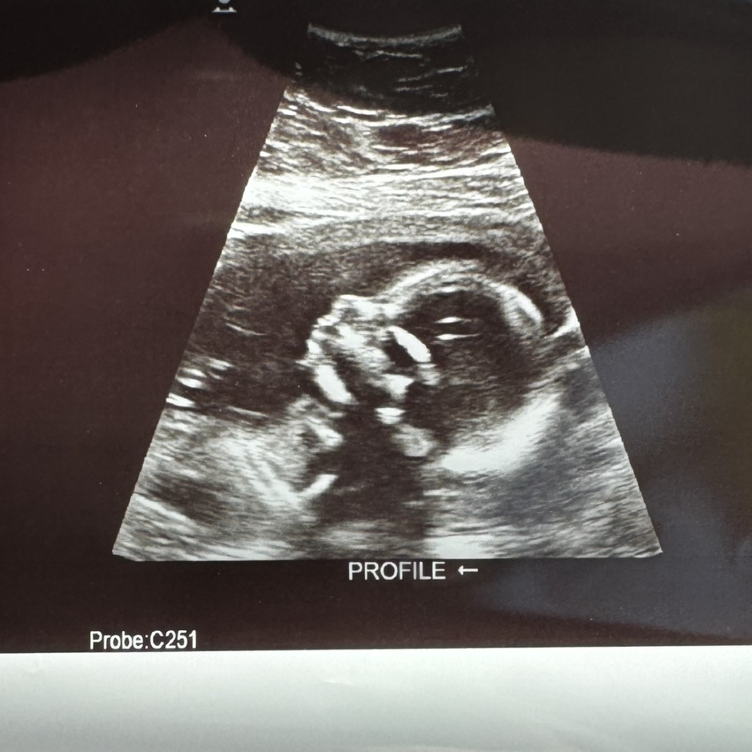 Photo shared by Courtney/Thomas for their Babylist baby registry.