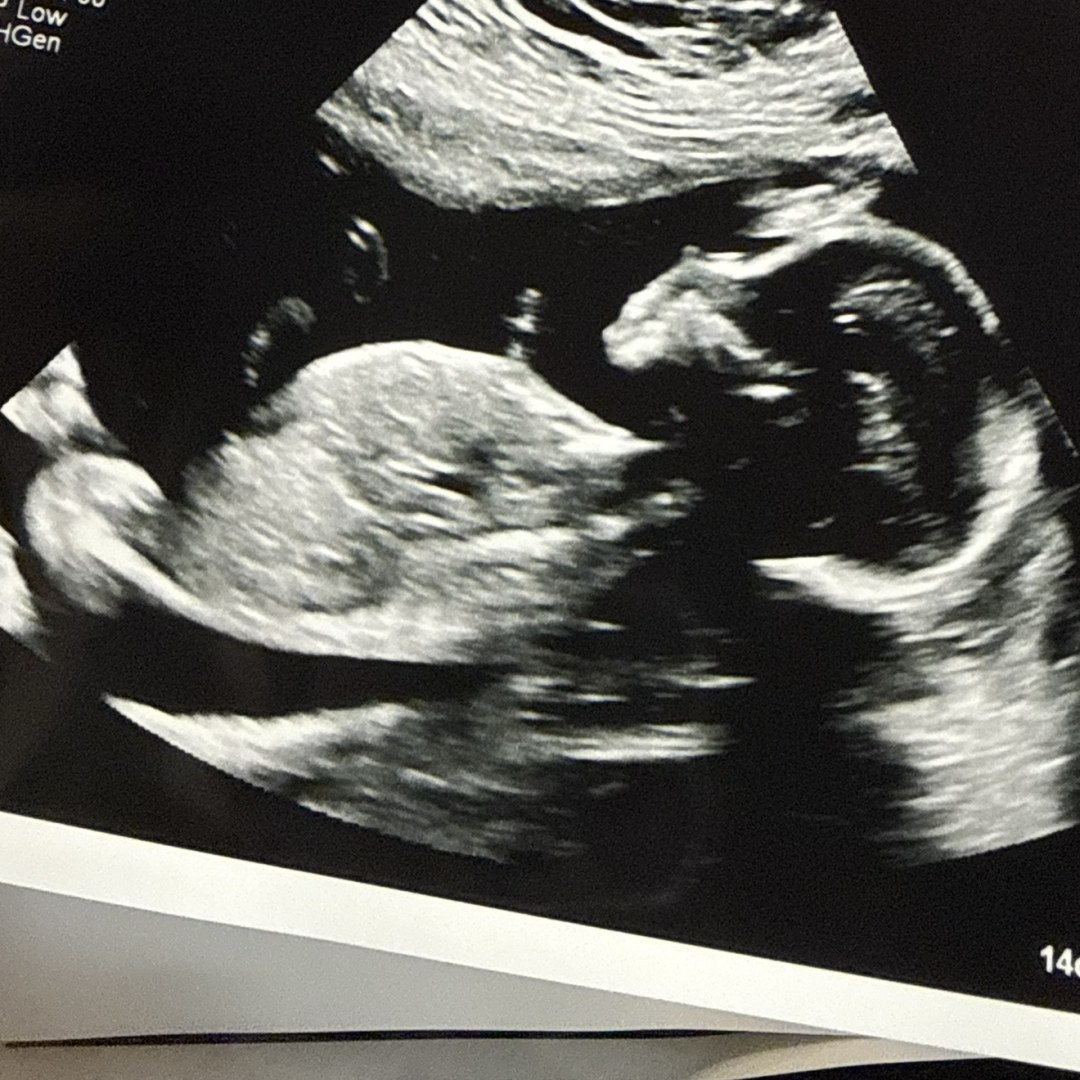 Photo shared by Lianne for their Babylist baby registry.