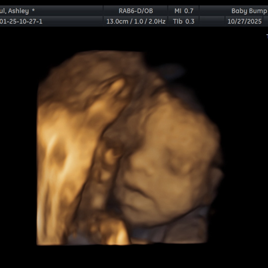 Photo shared by Ashley for their Babylist baby registry.