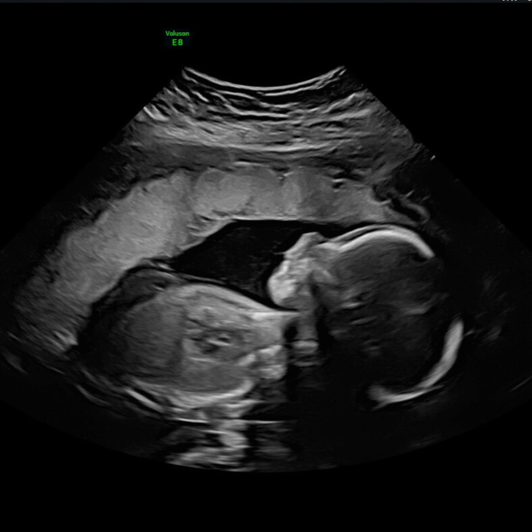 Photo shared by Savannah for their Babylist baby registry.