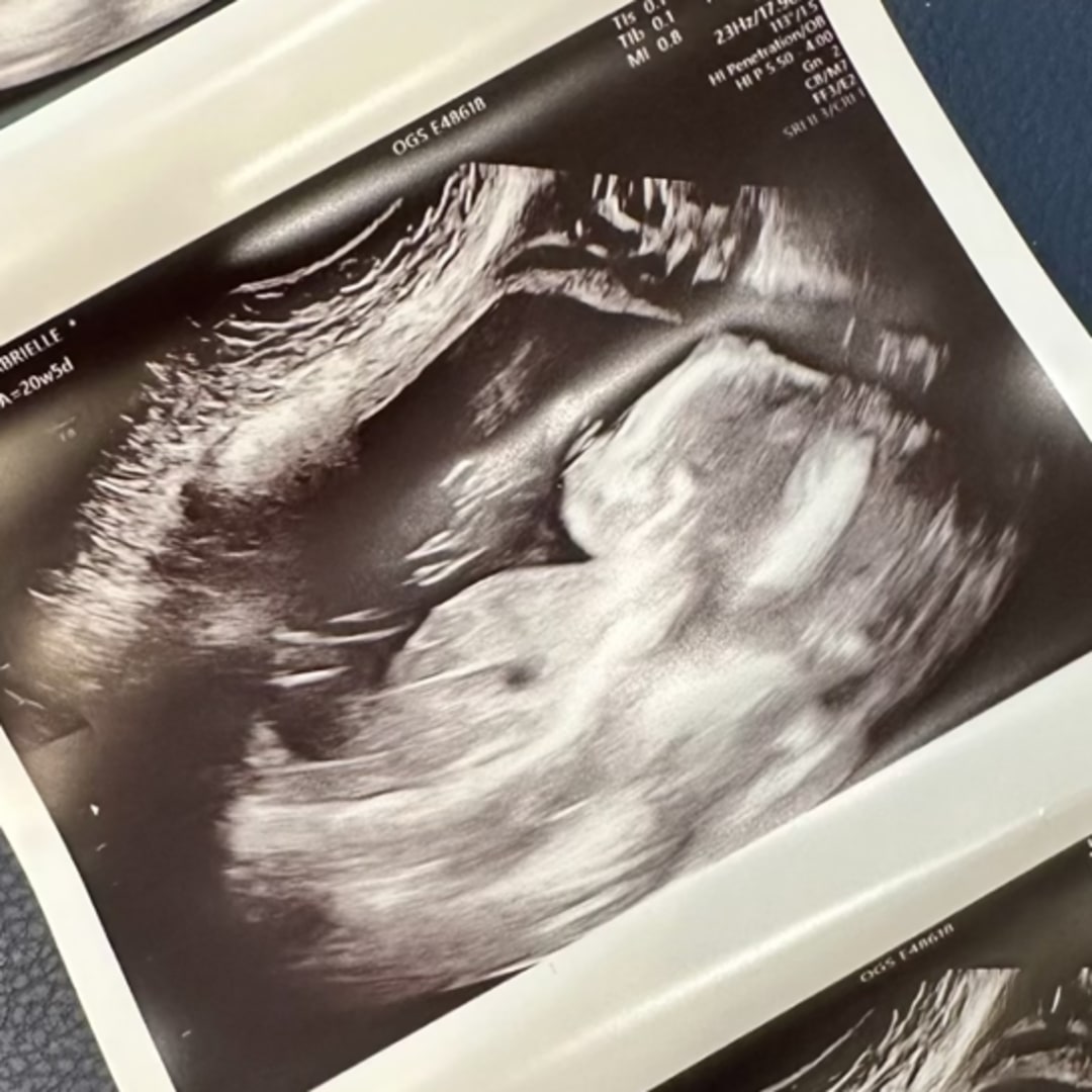 Photo shared by Gabrielle for their Babylist baby registry.