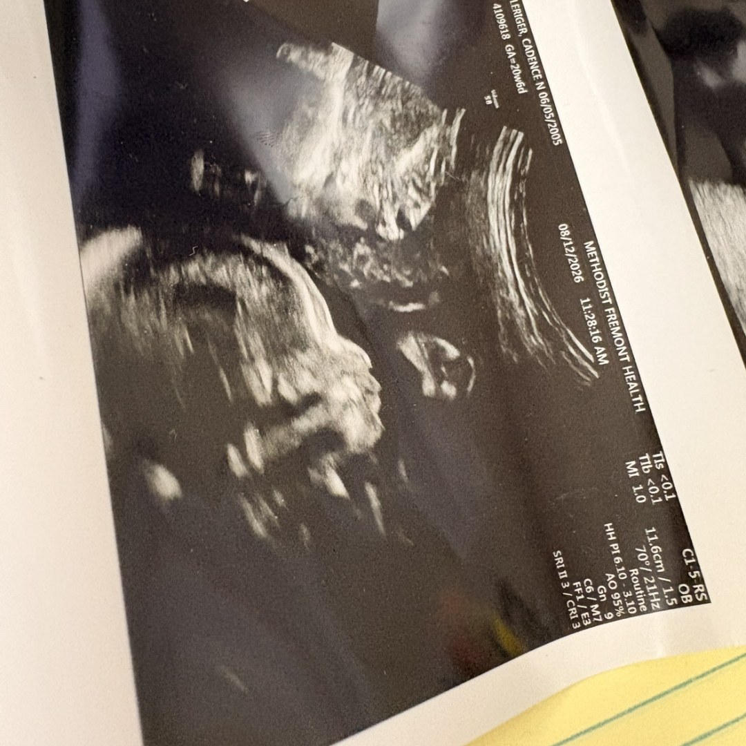 Photo shared by Cadence for their Babylist baby registry.