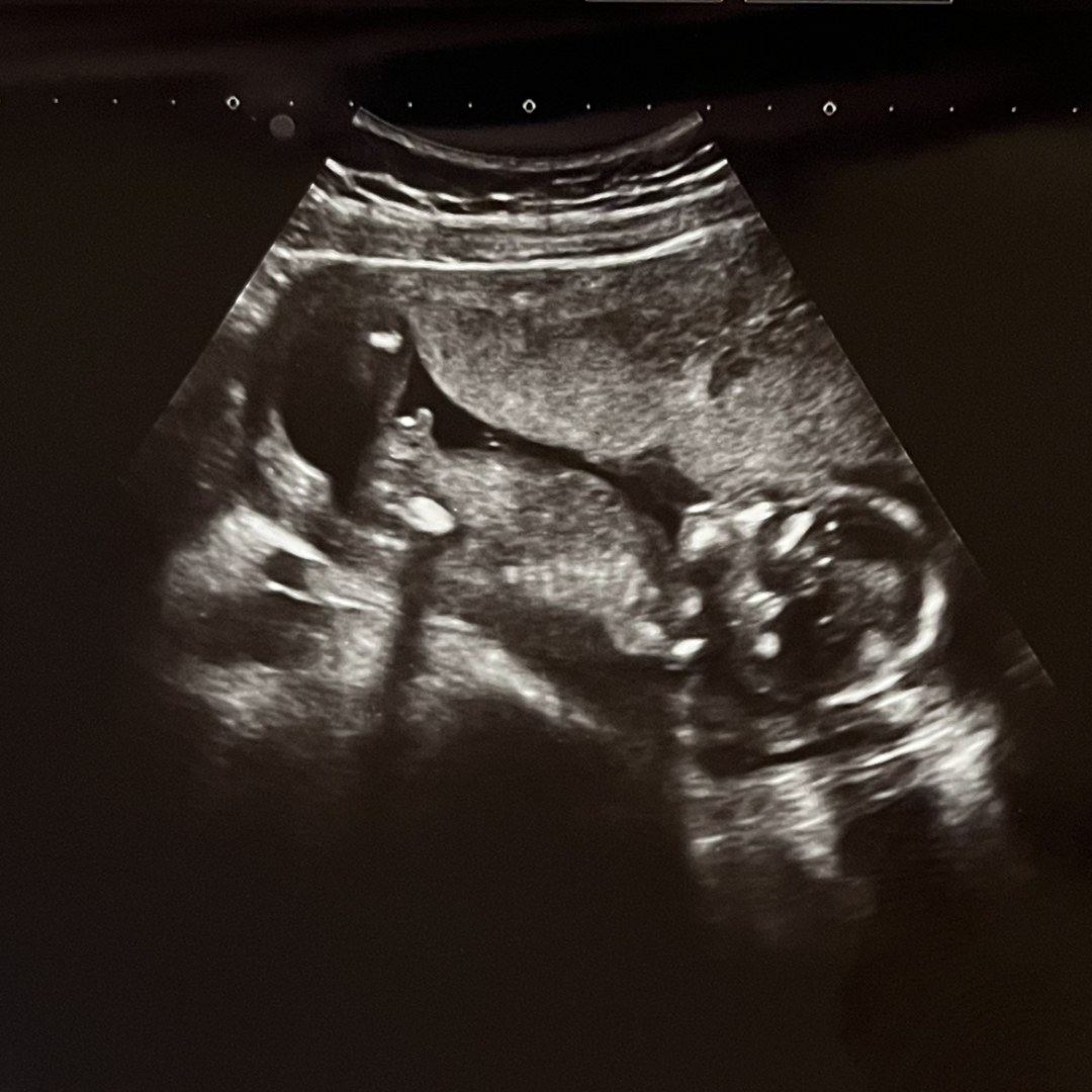 Photo shared by Sophia for their Babylist baby registry.