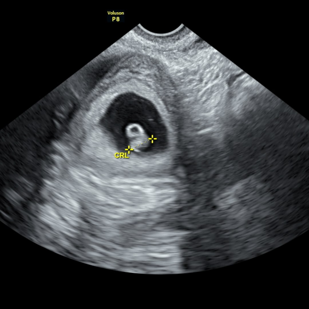 Photo shared by Isabella for their Babylist baby registry.