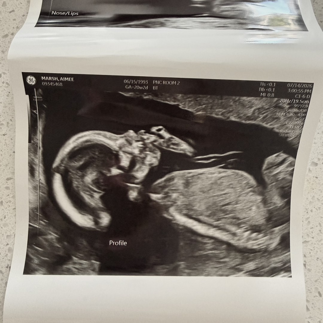Photo shared by Aimee for their Babylist baby registry.