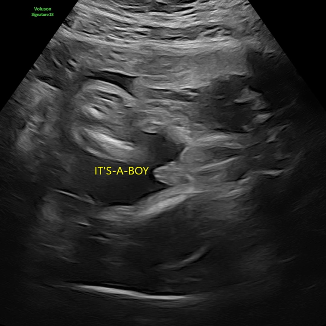 Photo shared by Fuiono for their Babylist baby registry.