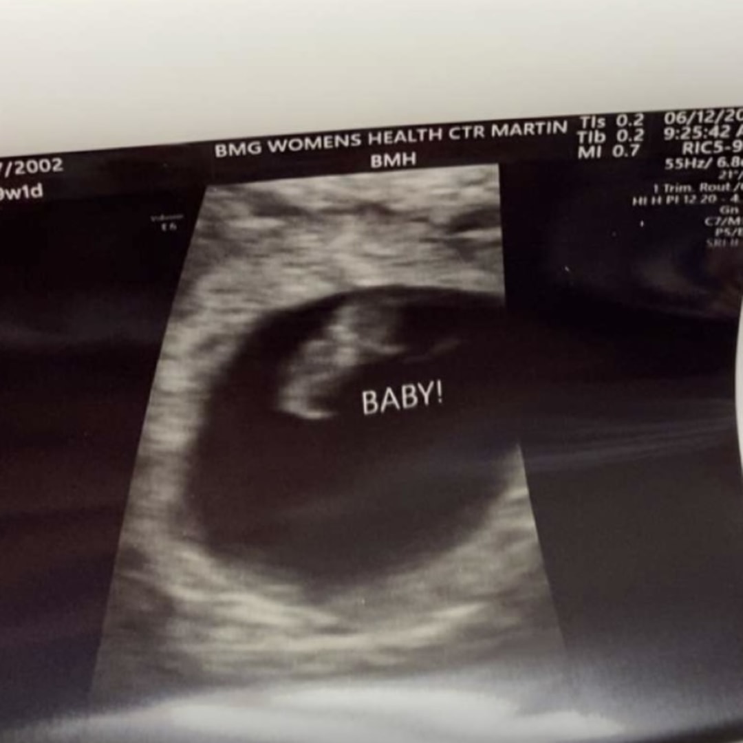 Photo shared by Ashley for their Babylist baby registry.