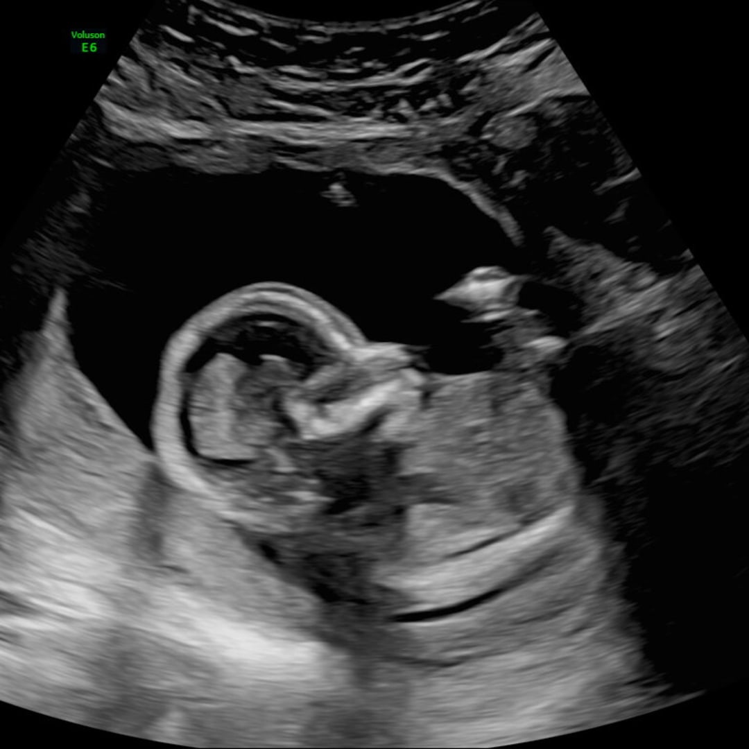 Photo shared by Vada for their Babylist baby registry.