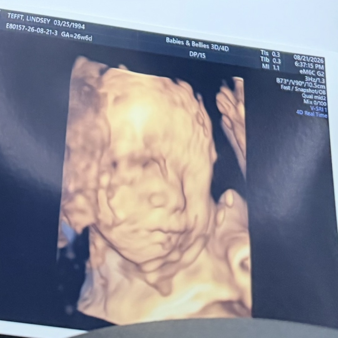 Photo shared by Lindsey for their Babylist baby registry.
