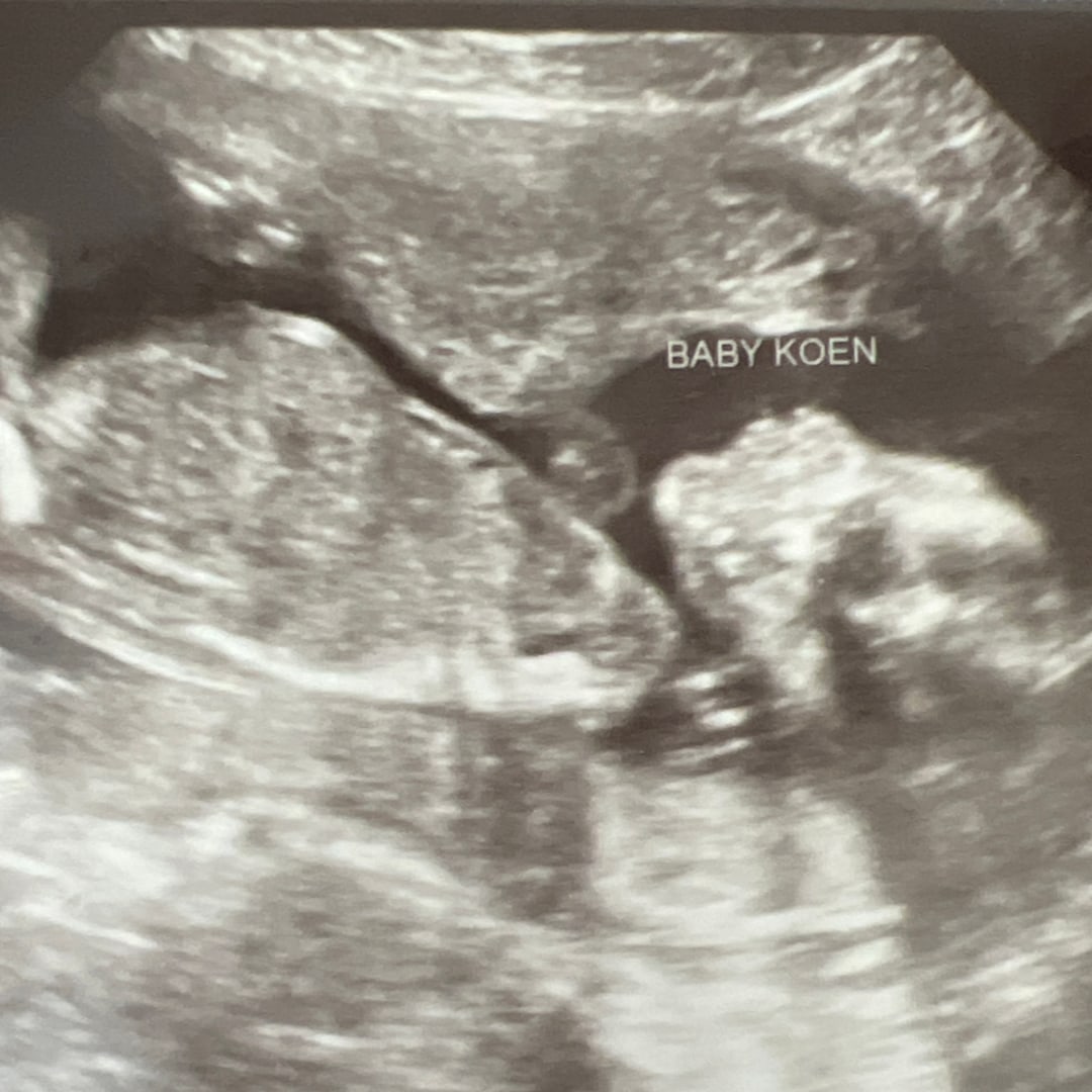Photo shared by Alayla for their Babylist baby registry.