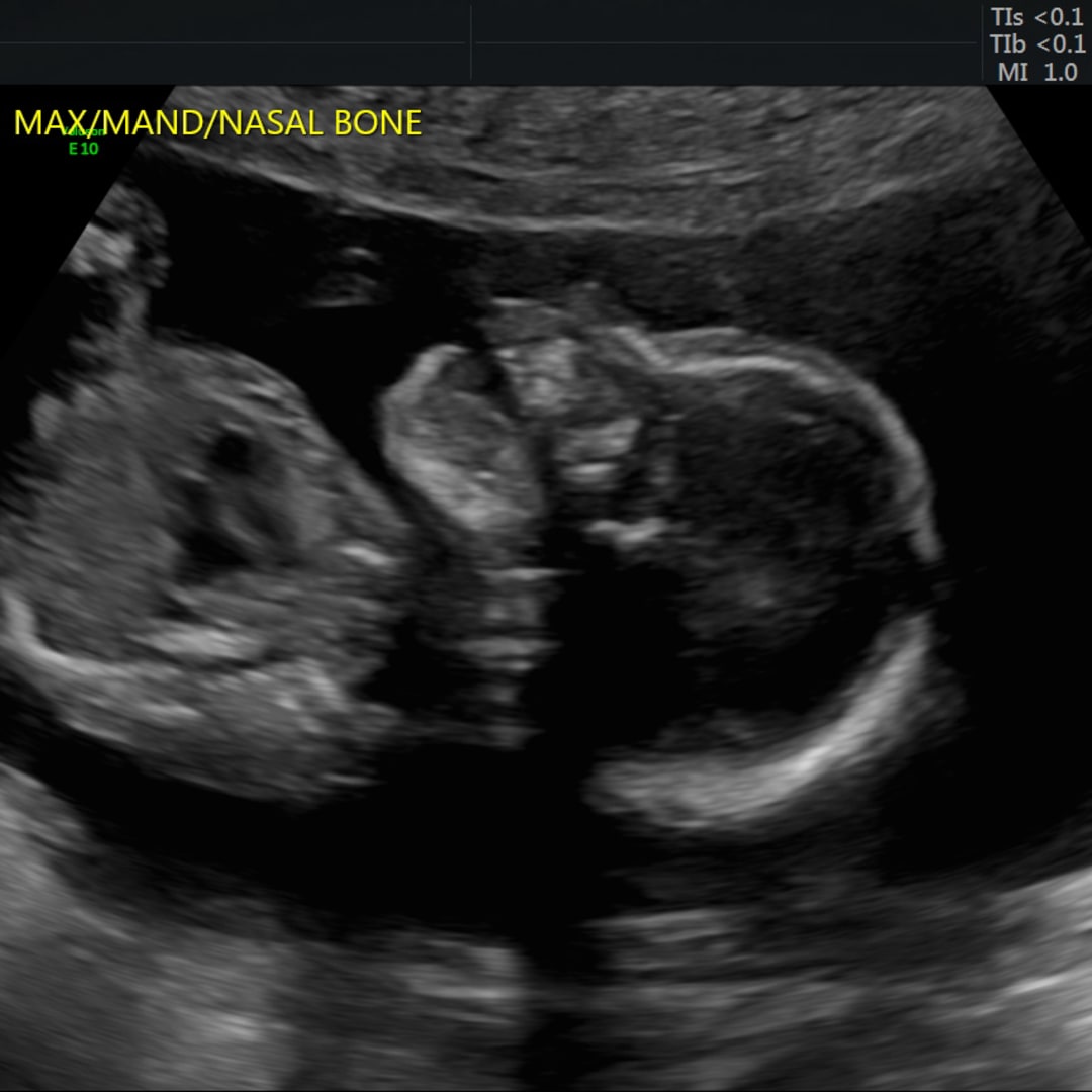 Photo shared by Maggie for their Babylist baby registry.