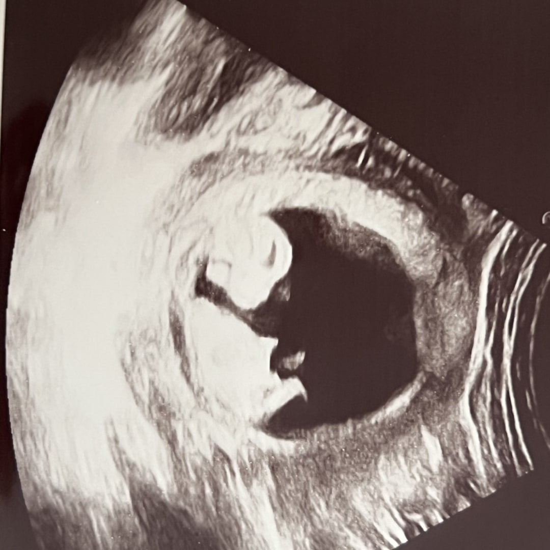 Photo shared by Caroline for their Babylist baby registry.