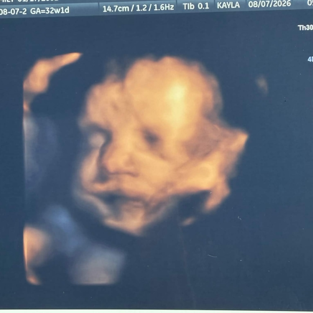 Photo shared by Emily for their Babylist baby registry.