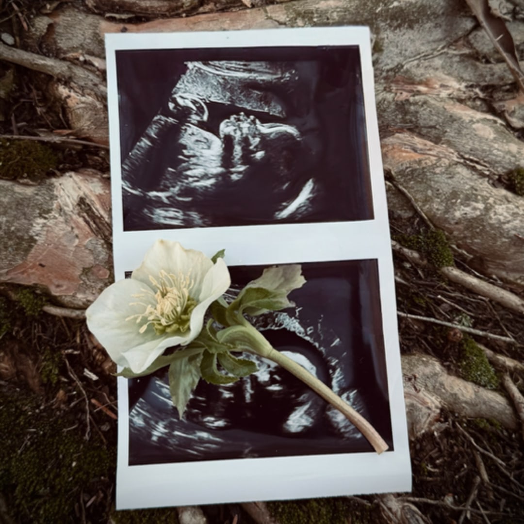 Photo shared by Rachael for their Babylist baby registry.