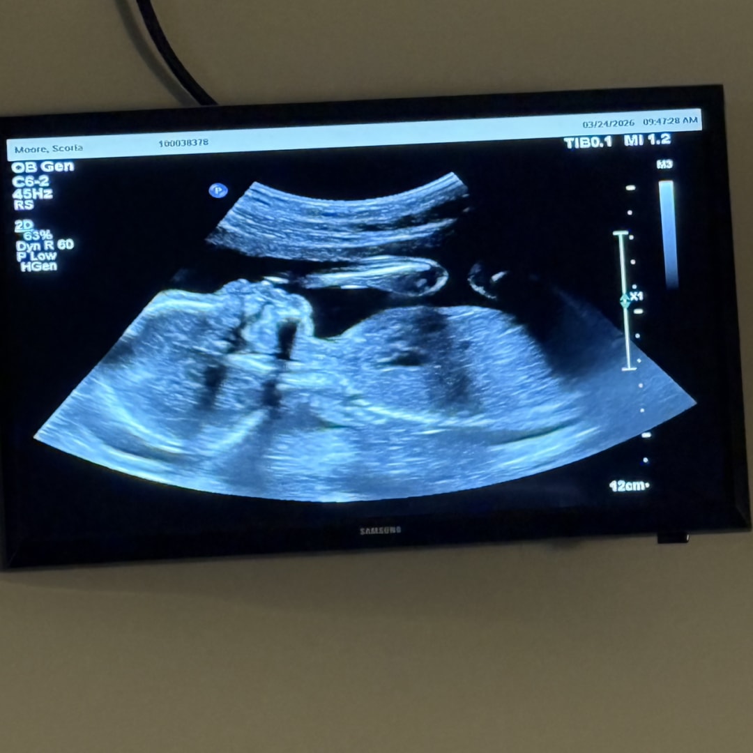 Photo shared by S’coria for their Babylist baby registry.