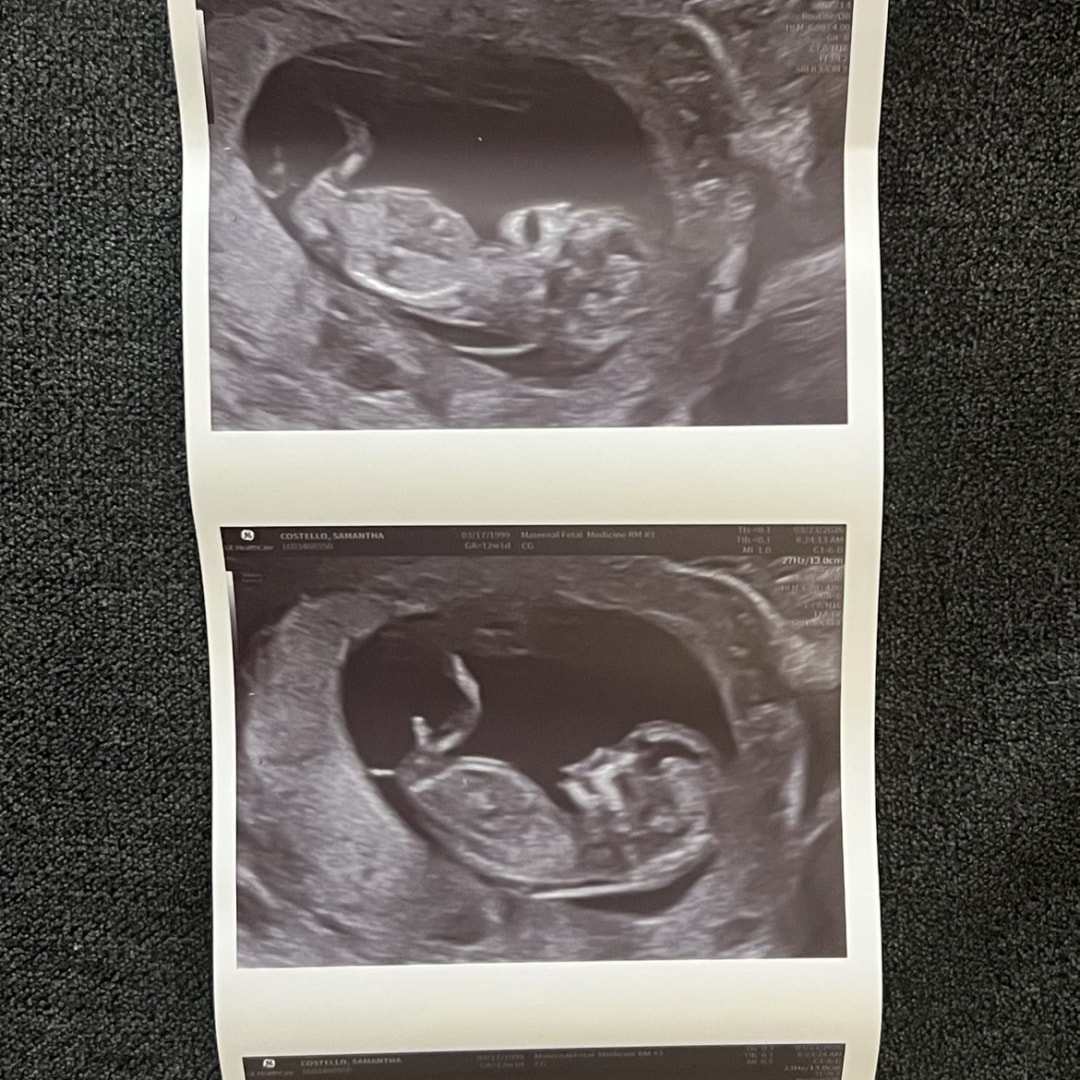 Photo shared by Samie for their Babylist baby registry.