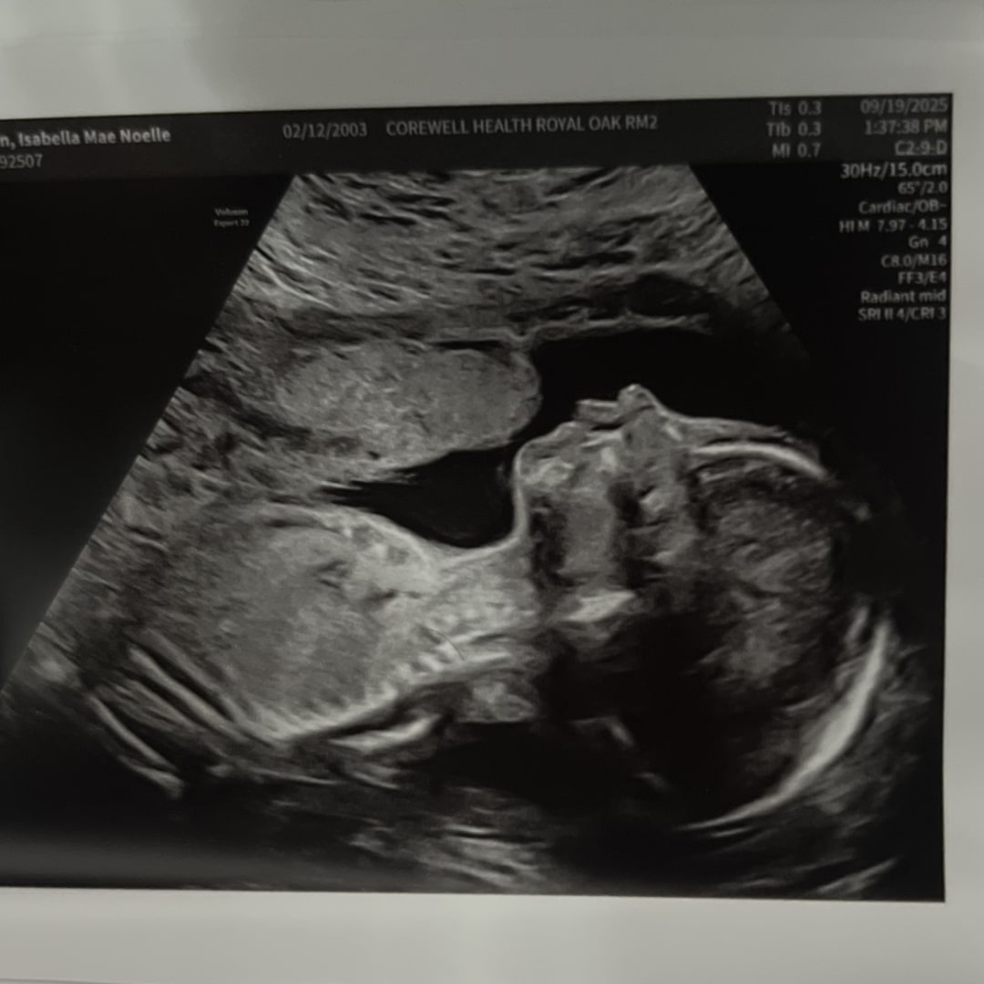 Photo shared by Isabella for their Babylist baby registry.