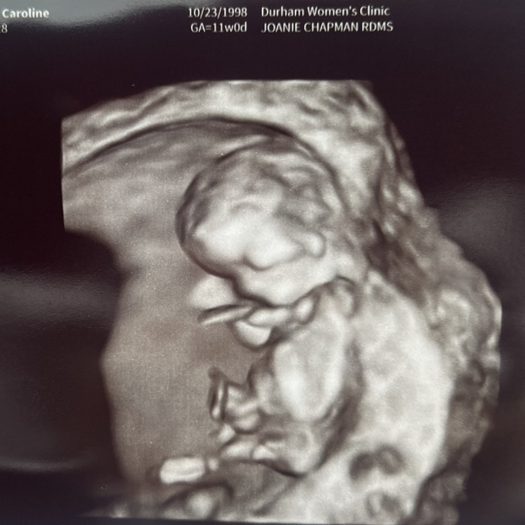 Photo shared by Caroline for their Babylist baby registry.