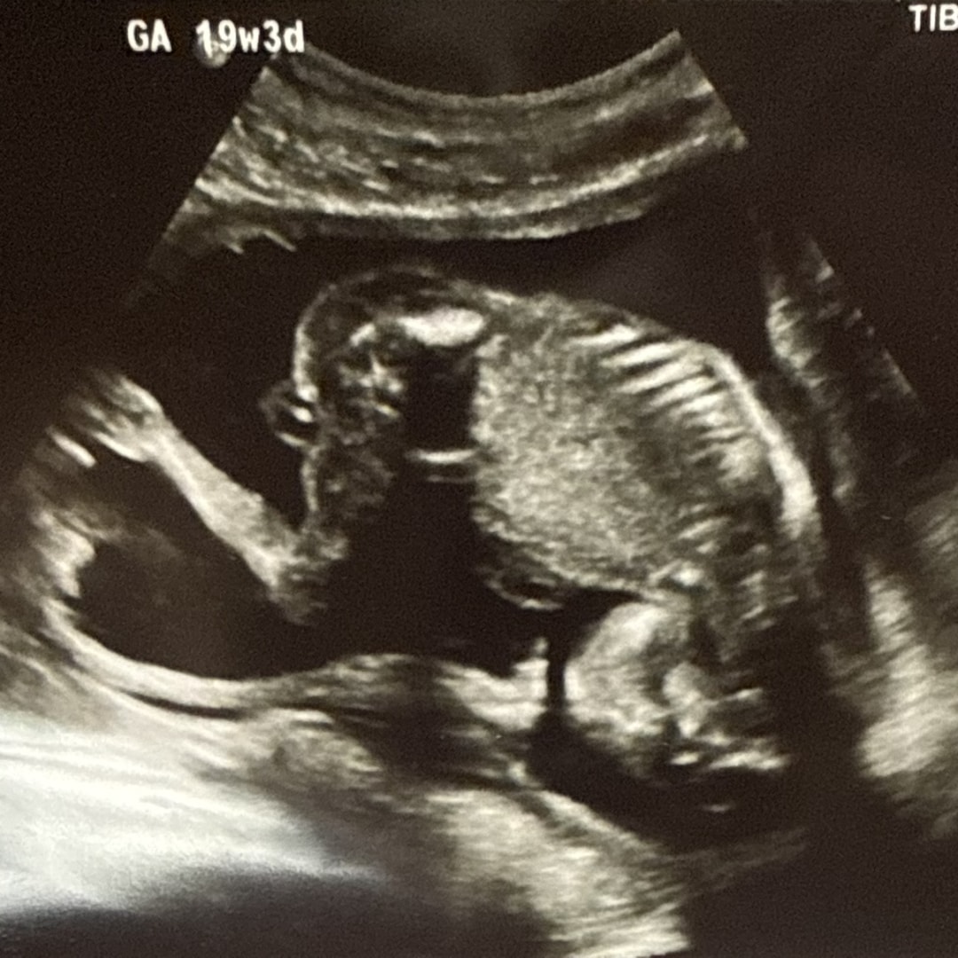 Photo shared by Alexis for their Babylist baby registry.