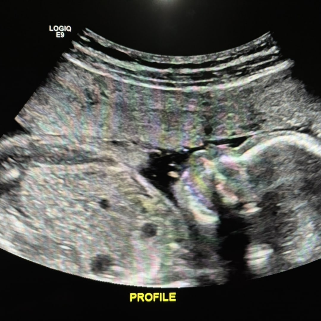 Photo shared by Savannah for their Babylist baby registry.