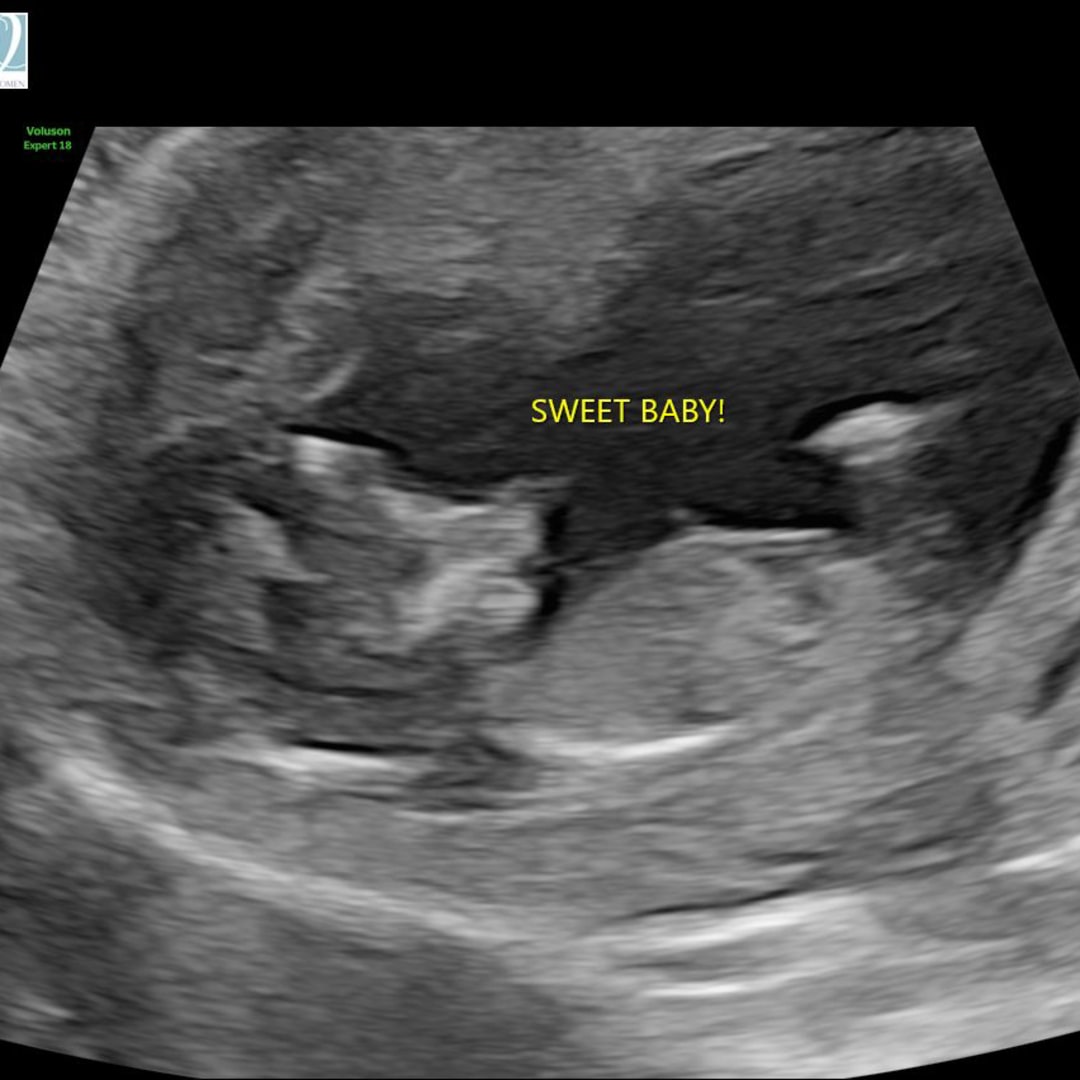 Photo shared by Brittany for their Babylist baby registry.