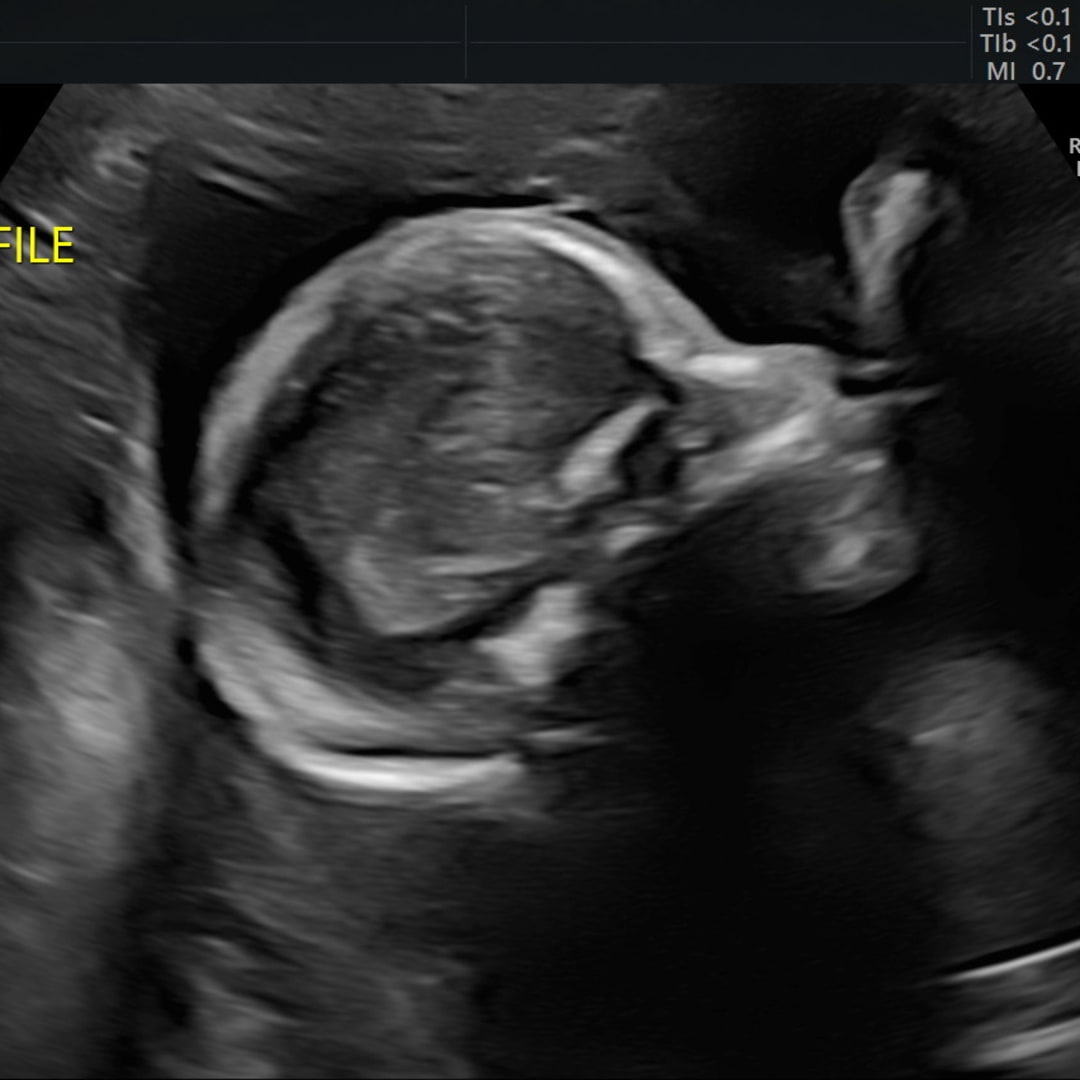 Photo shared by Natalie for their Babylist baby registry.