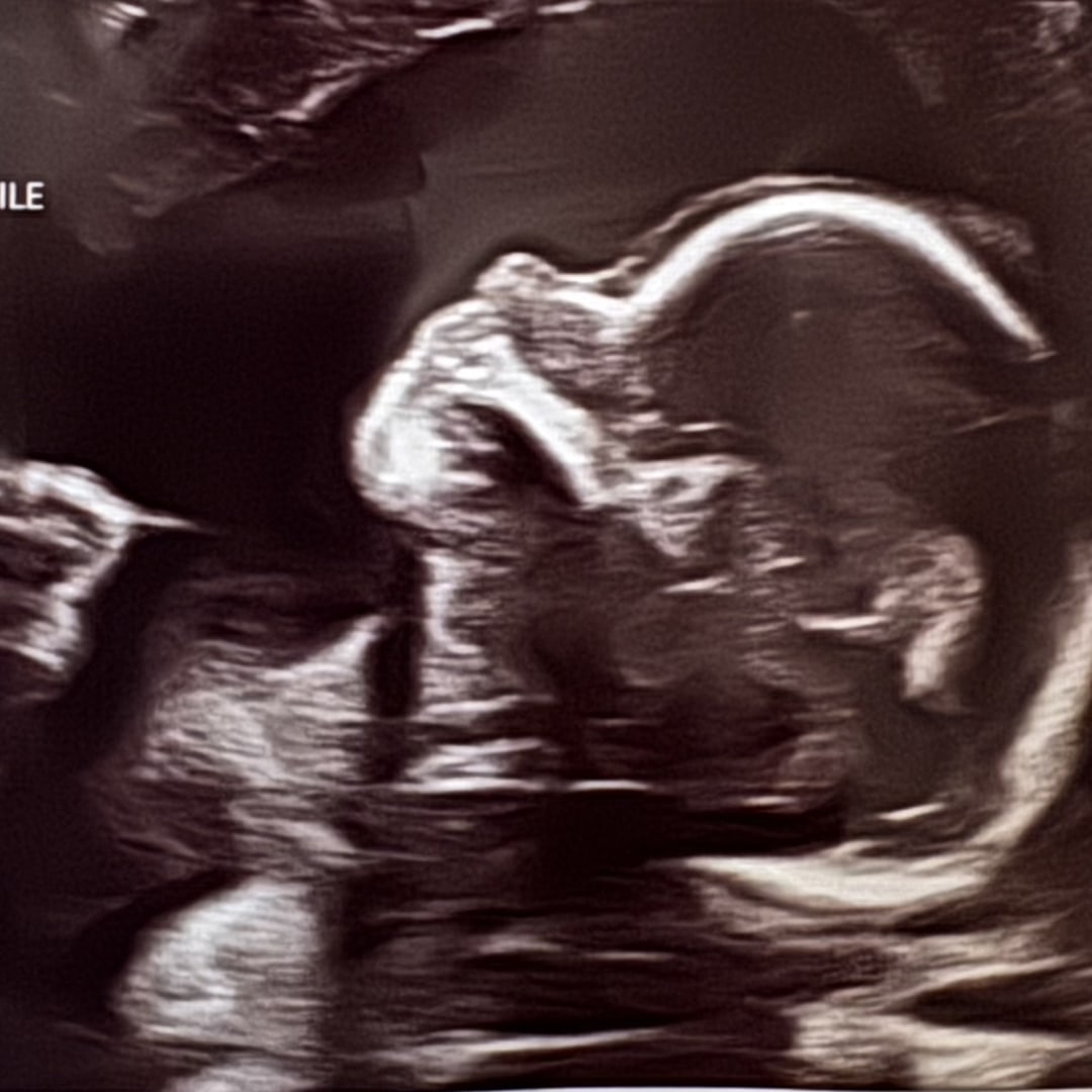 Photo shared by Elizabeth for their Babylist baby registry.