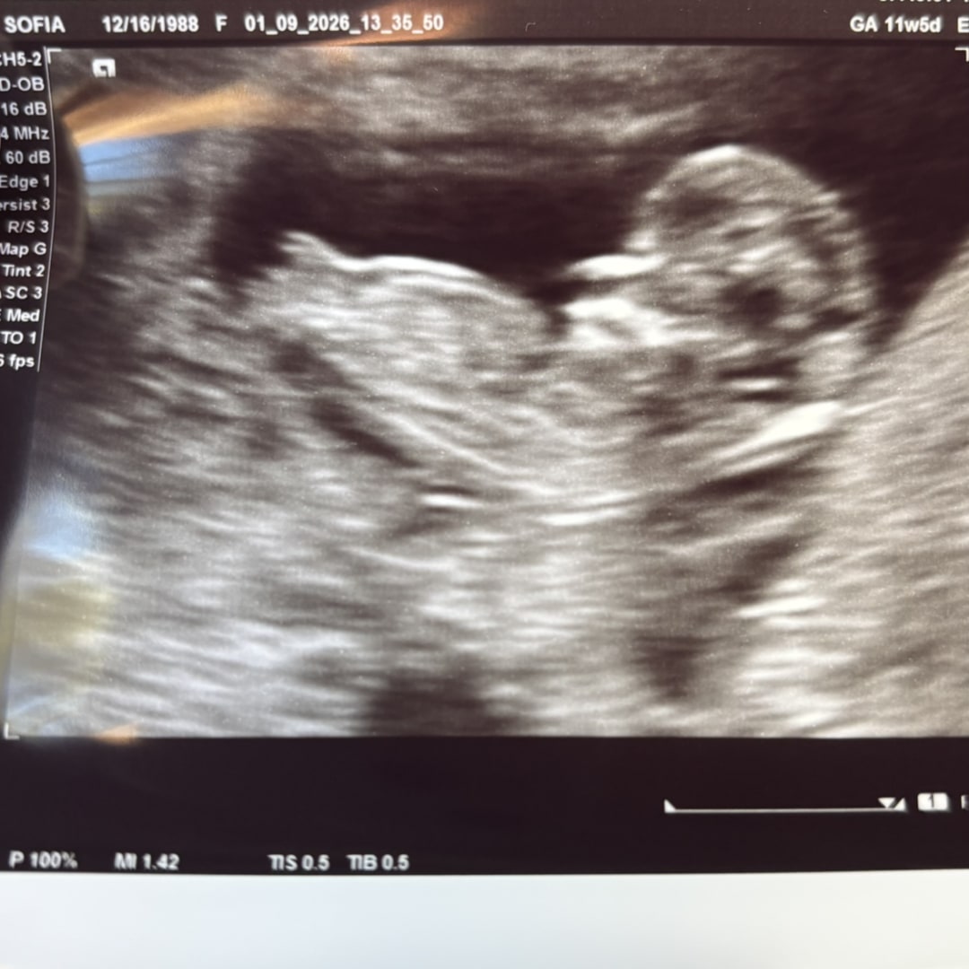 Photo shared by Sofia for their Babylist baby registry.