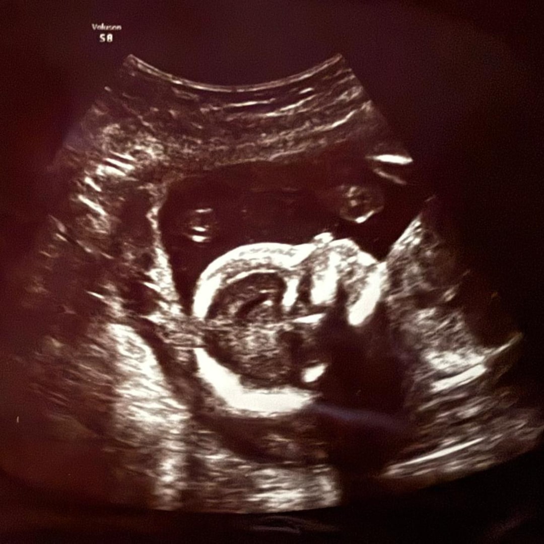 Photo shared by Nainoa for their Babylist baby registry.