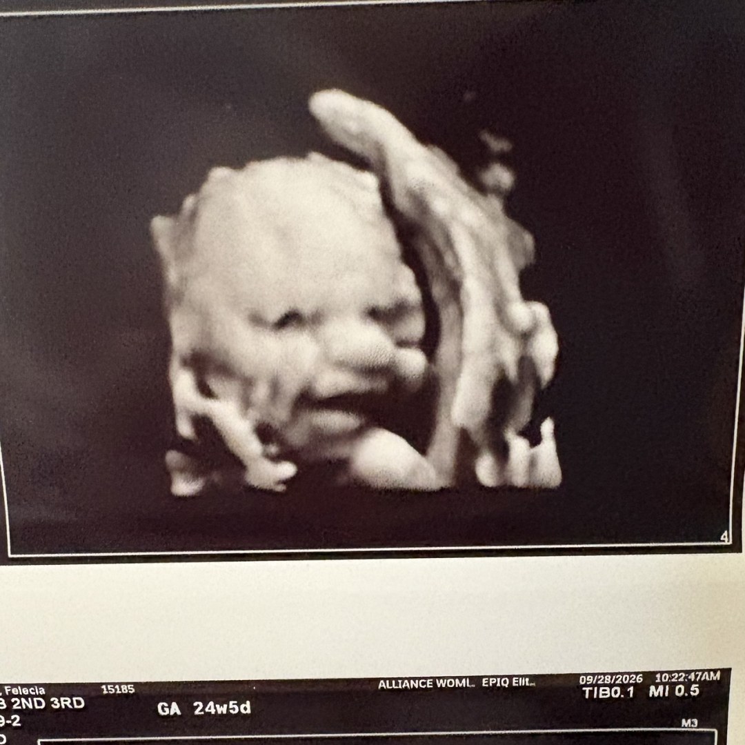 Photo shared by Felecia for their Babylist baby registry.
