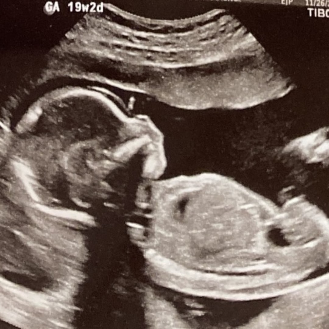 Photo shared by Sydney for their Babylist baby registry.