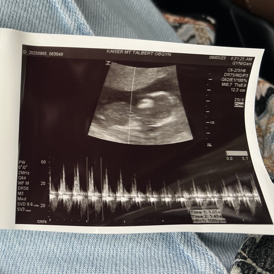 Photo shared by Emily for their Babylist baby registry.