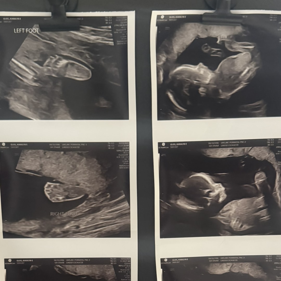 Photo shared by Karalyn for their Babylist baby registry.